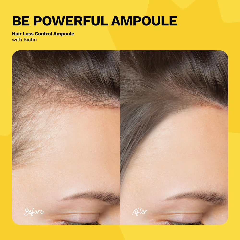 Ginger Milk Hair Growth Ampoule three-pack box image highlights value and routine consistency.