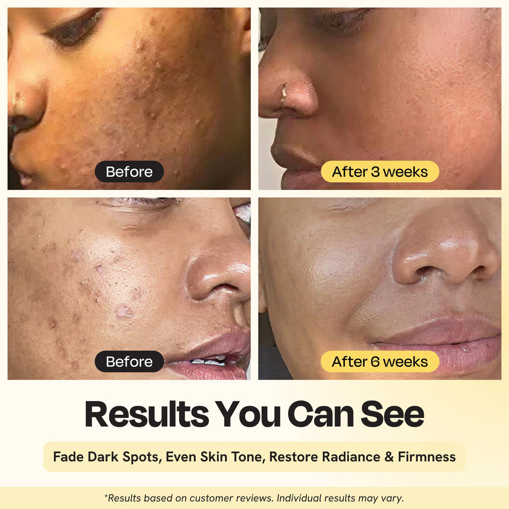 Gleamin serum dropper close-up for quick daytime application