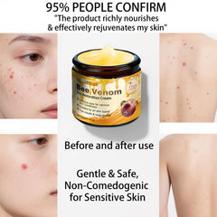 Gliowia Bee Venom Cream glass tube indicates premium moisturizer