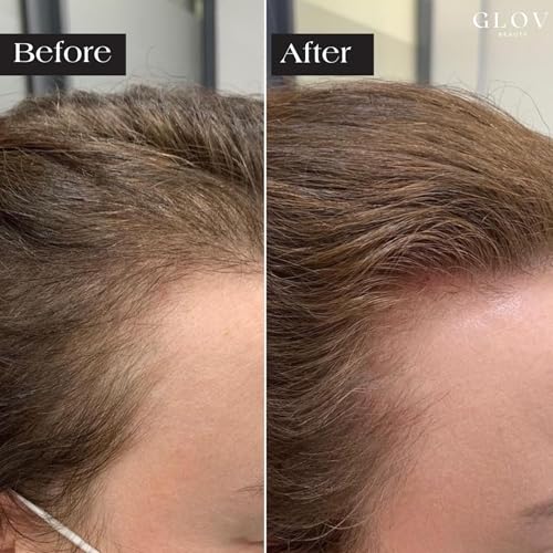 Glov Beauty peptide serum ampoules highlighting concentrated nutrients for scalp hydration