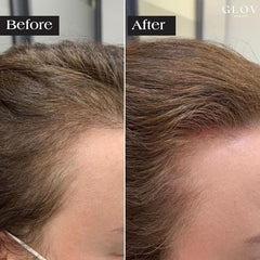 Glov Beauty peptide serum ampoules highlighting concentrated nutrients for scalp hydration