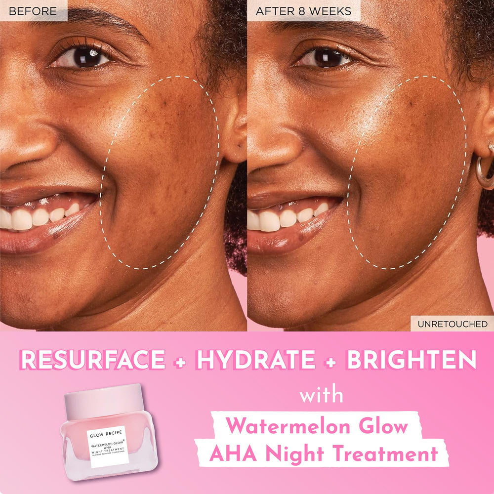 Glow Recipe Watermelon Glow Night Treatment with hyaluronic acid for multi-level hydration.