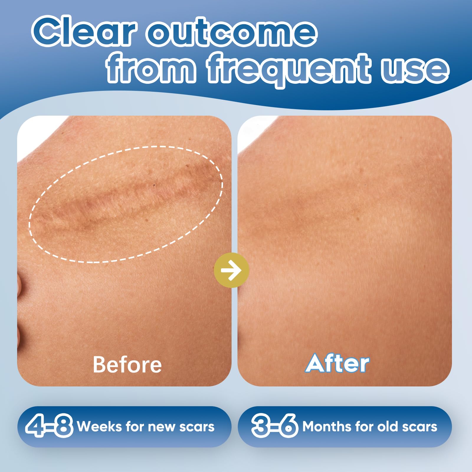 Glowor Advanced Silicone Scar Gel skin close-up shows gentle formula for sensitive skin.