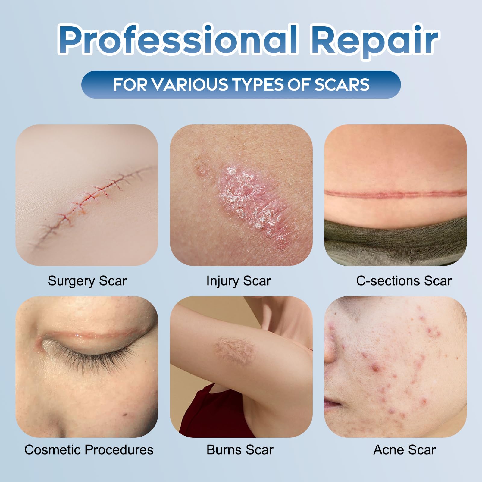 Glowor Advanced Silicone Scar Gel texture swirl indicating even skin texture.