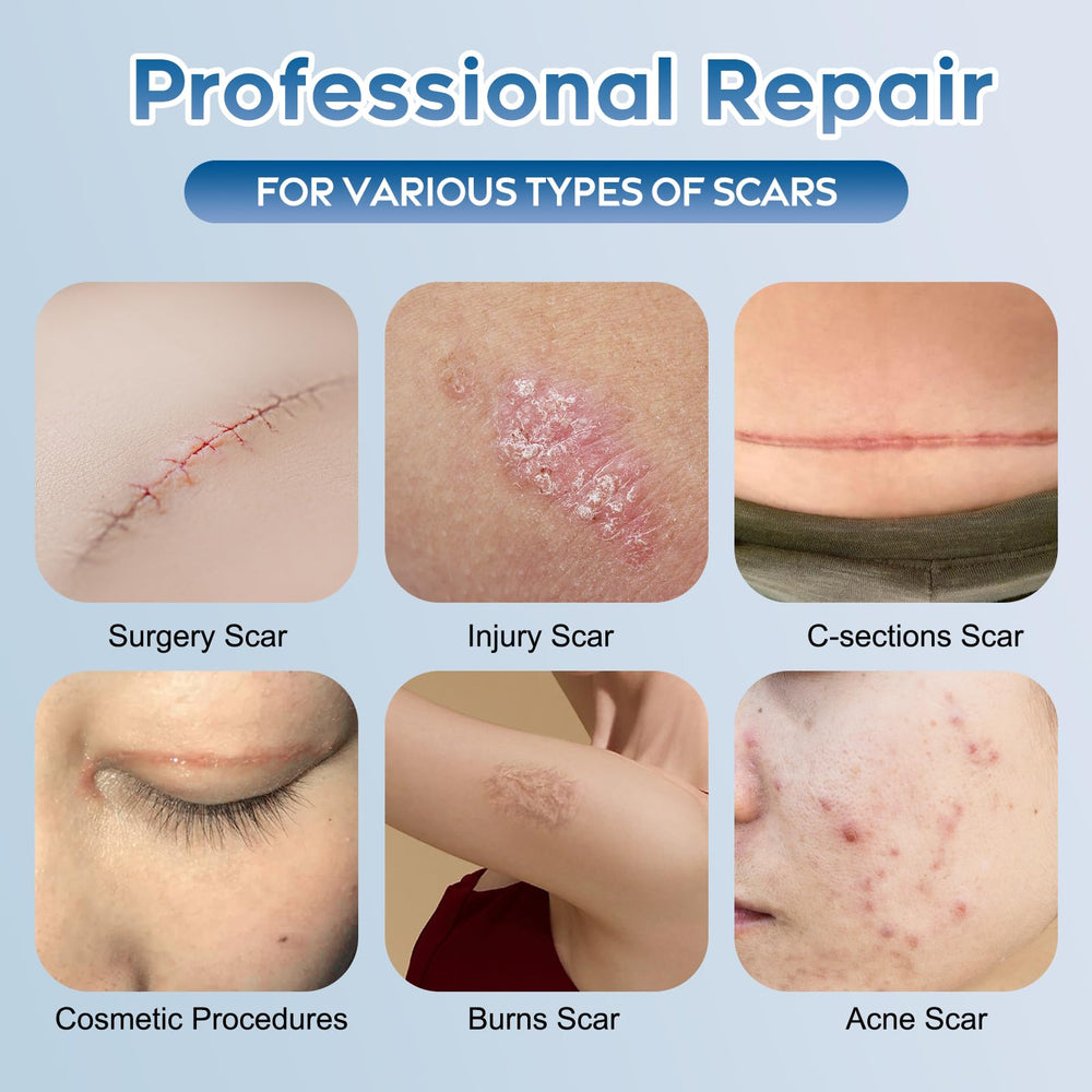 Glowor Advanced Silicone Scar Gel texture swirl indicating even skin texture.