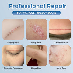 Glowor Advanced Silicone Scar Gel texture swirl indicating even skin texture.