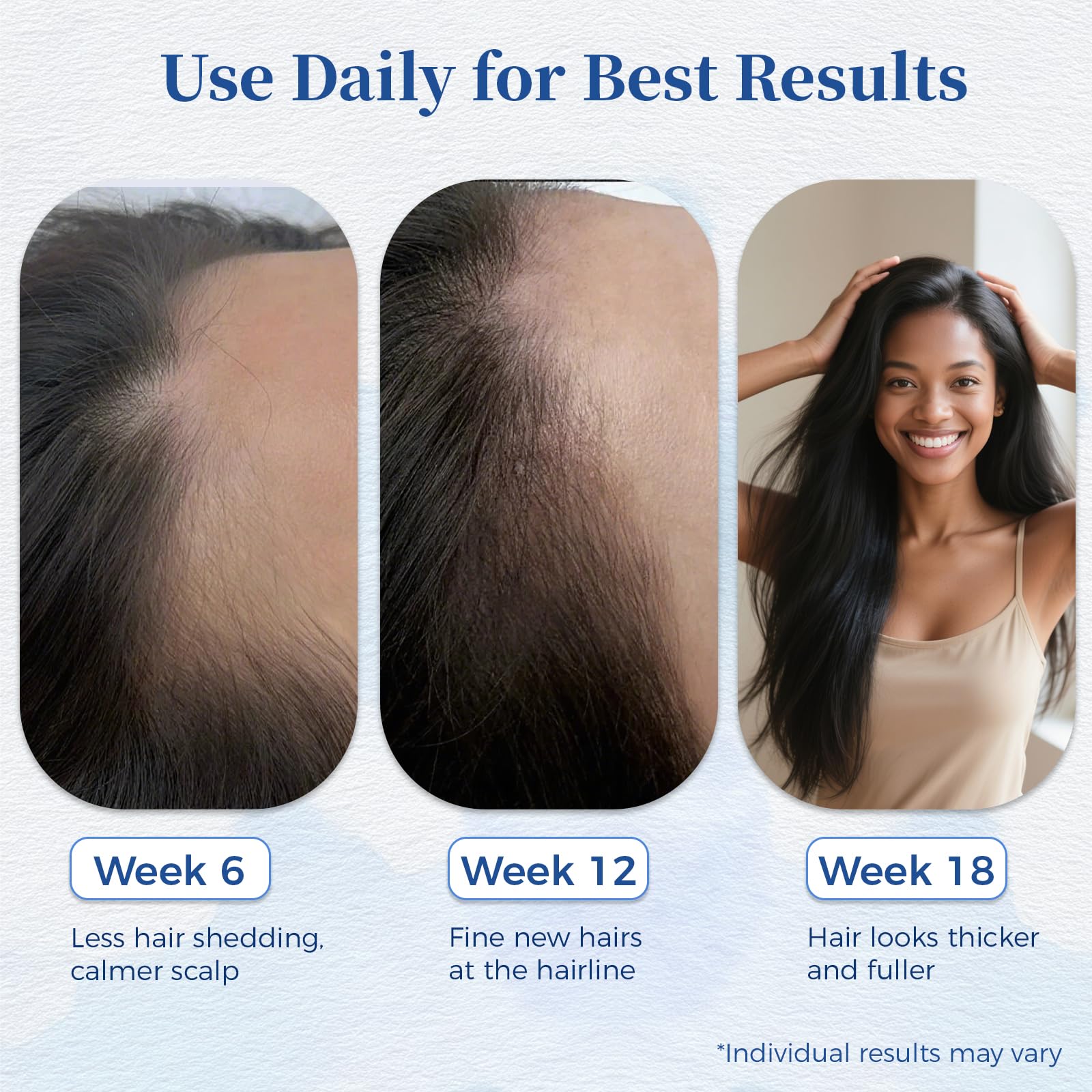 Gluvelessia Hair Growth Serum Roll On roller closeup highlights stainless steel ball for precise application