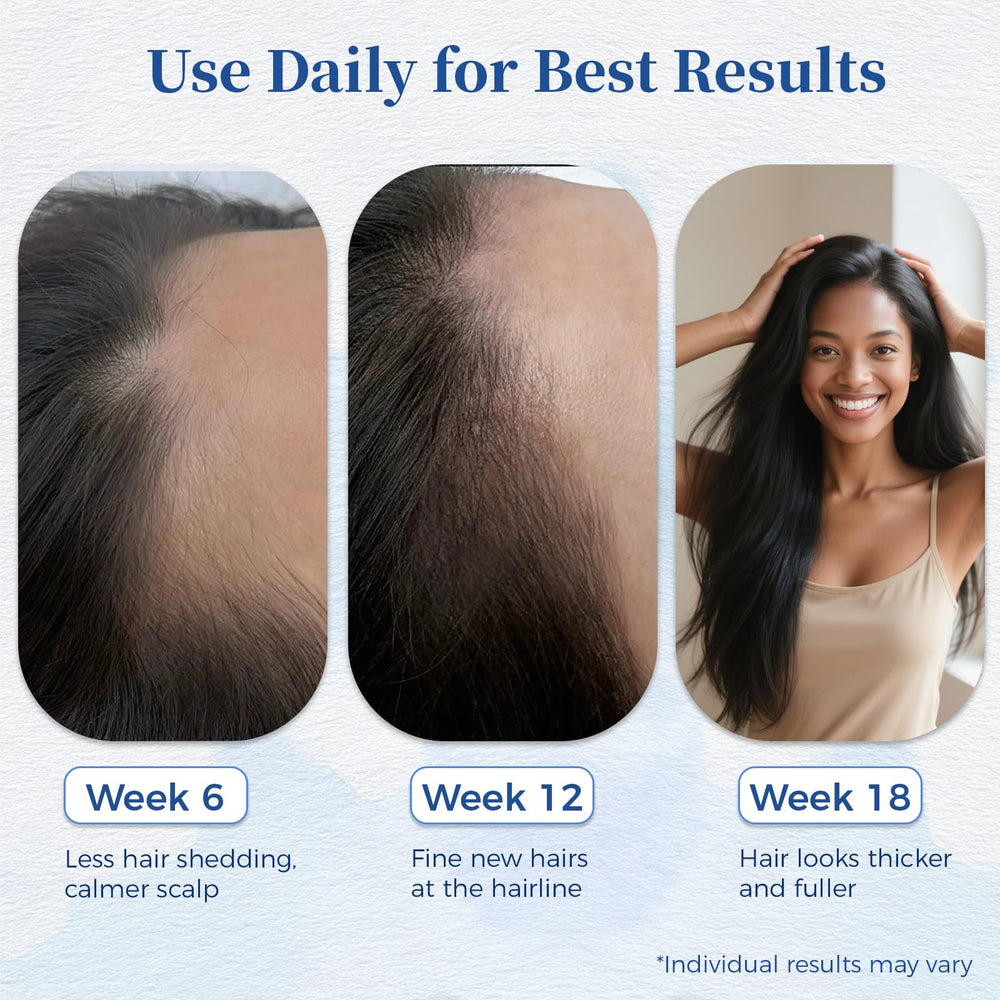 Gluvelessia Hair Growth Serum Roll On roller closeup highlights stainless steel ball for precise application