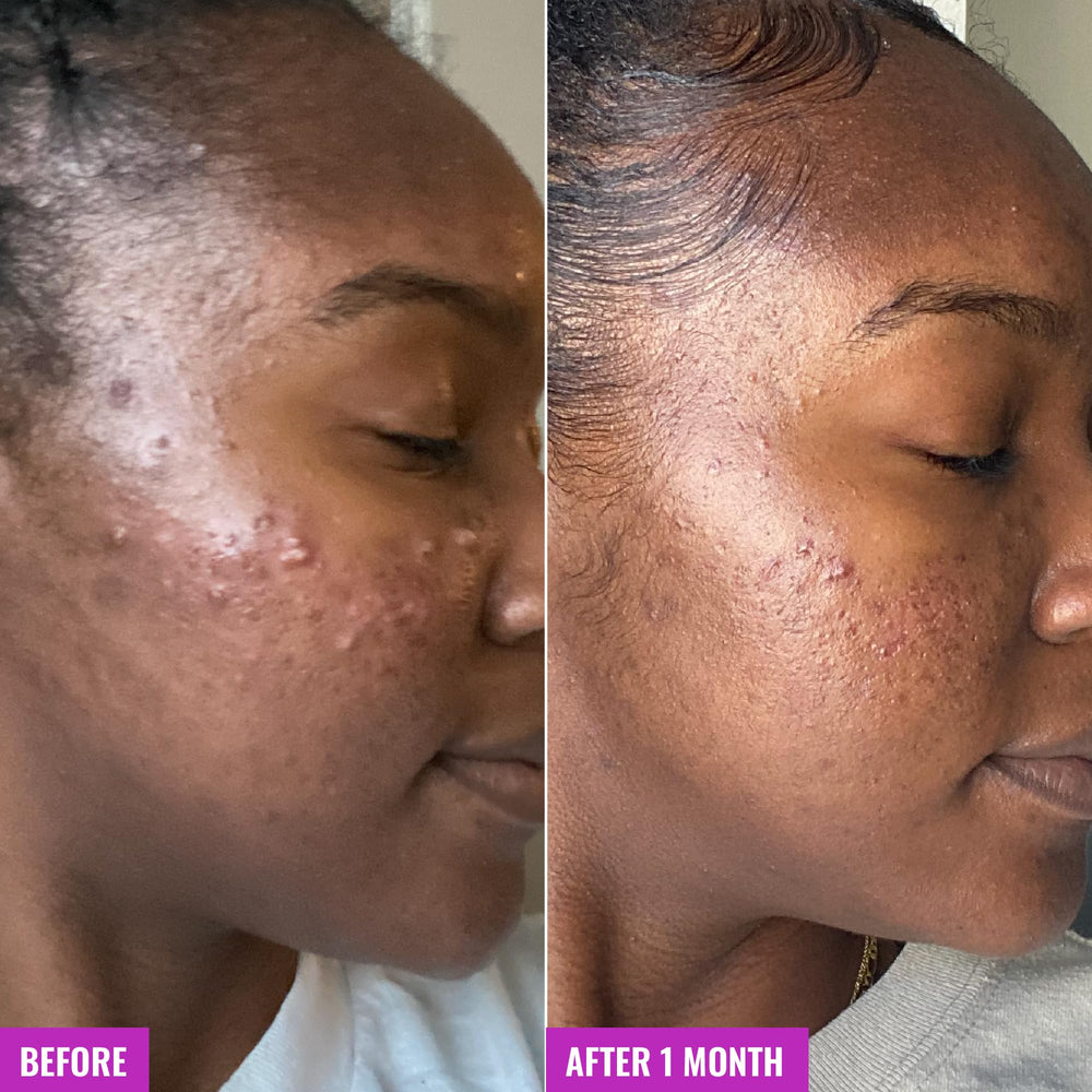 Good Molecules Acne Foaming Cleanser application foam showing 20-30 second massage.