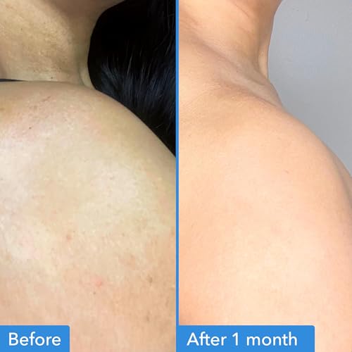 Good Molecules Discoloration Correcting Body Treatment texture close-up showing creamy hydration.