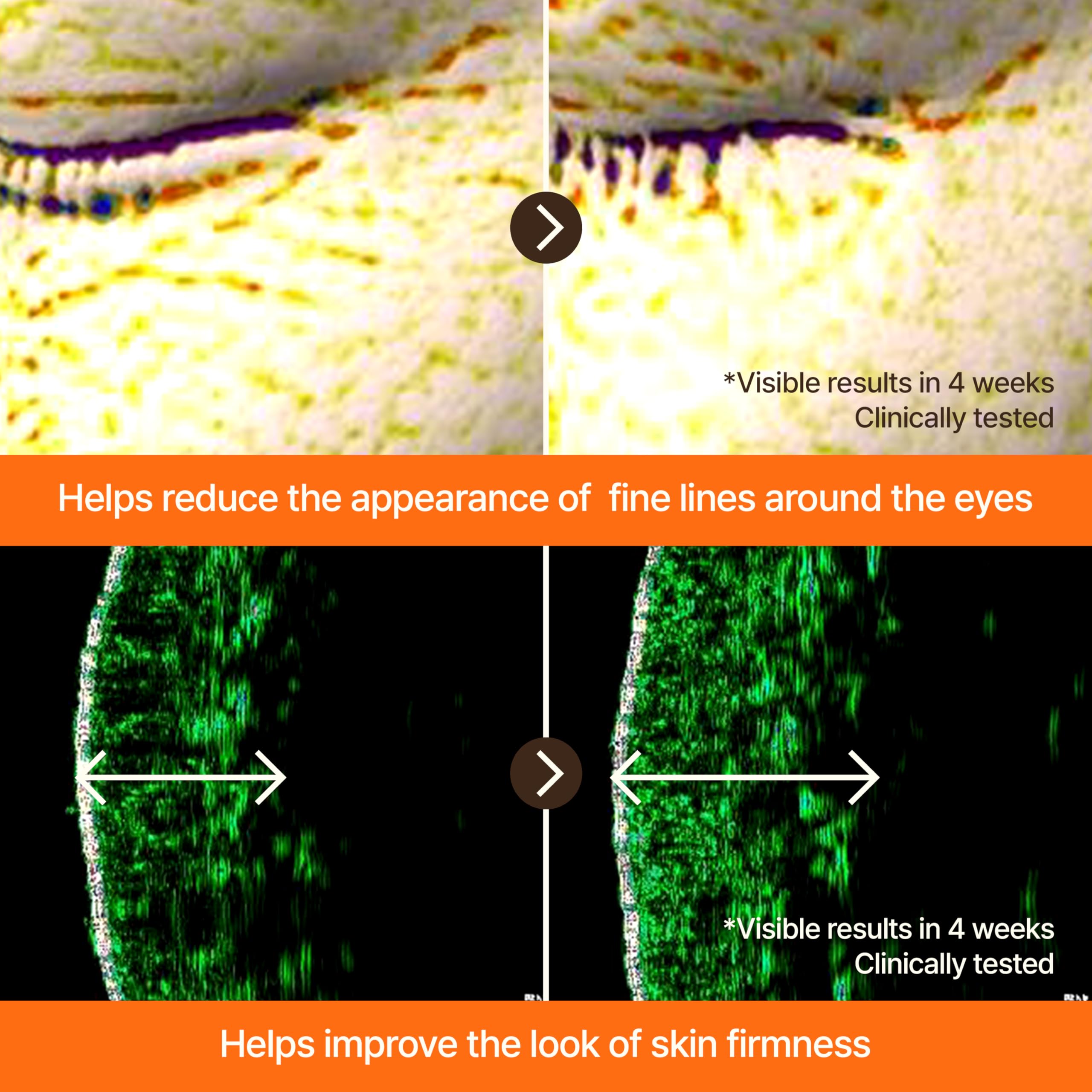 GOODAL Black Carrot Vita-A Serum dark-spot correction close-up targeting uneven tone