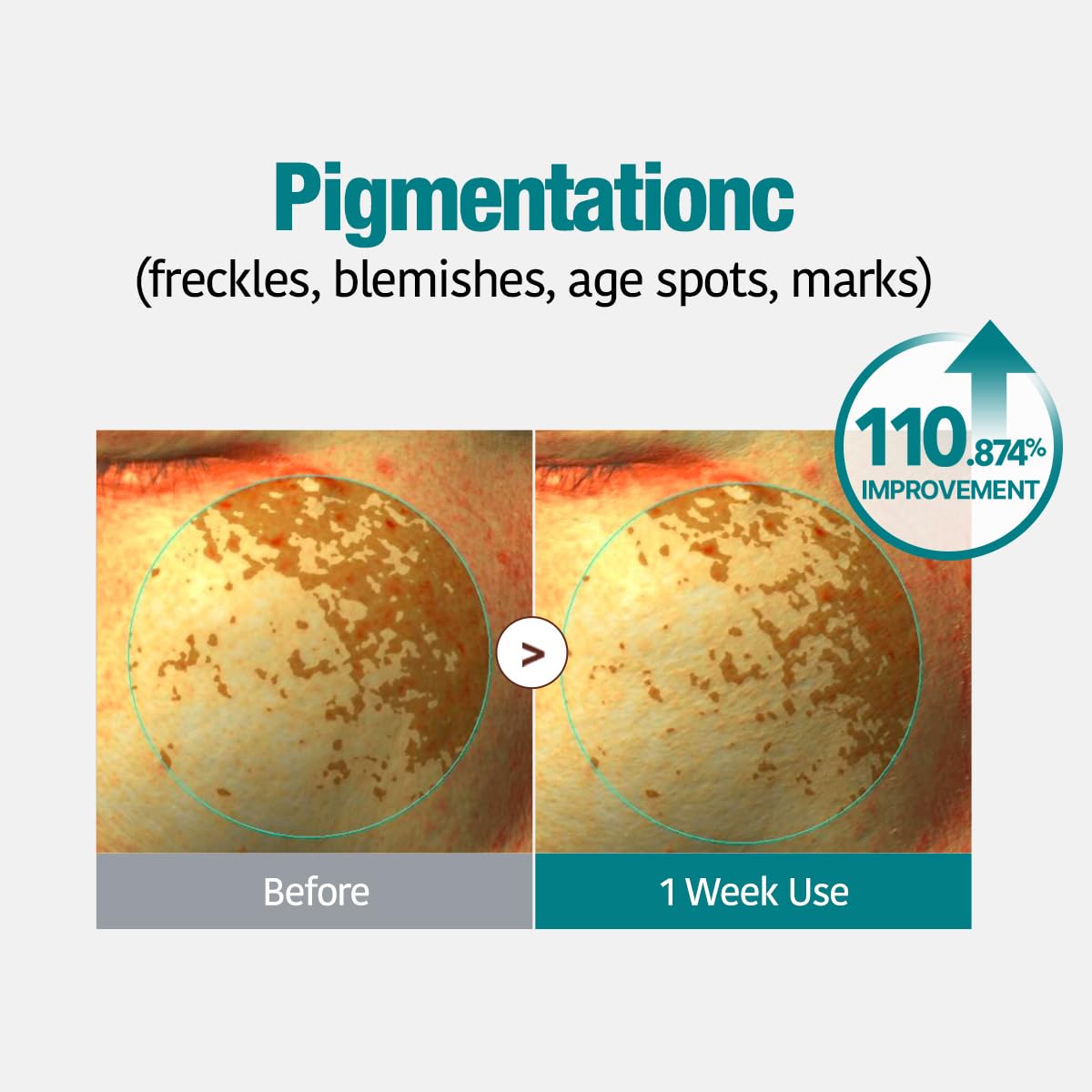 GOODAL gel mask on face demonstrates cooling hydrogel delivering soothing hydration.