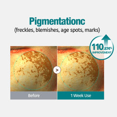 GOODAL gel mask on face demonstrates cooling hydrogel delivering soothing hydration.