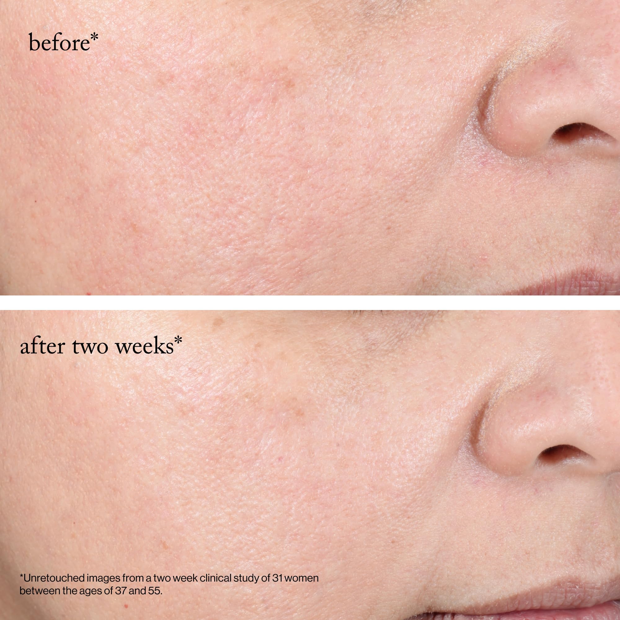 Goop Beauty glycolic pads demonstrated with visible skin radiance improvement.