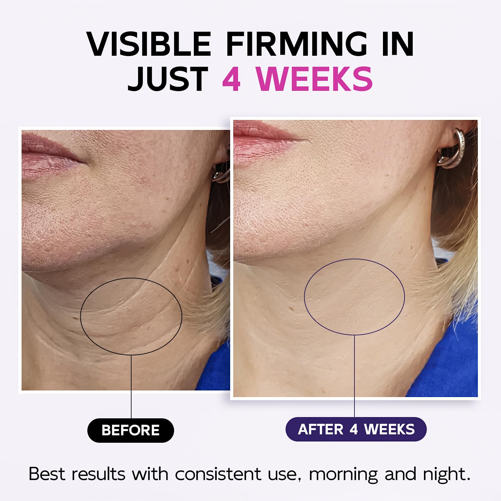 GOOSURE retinol-neck-cream close-up highlights potential firming and smoother texture.