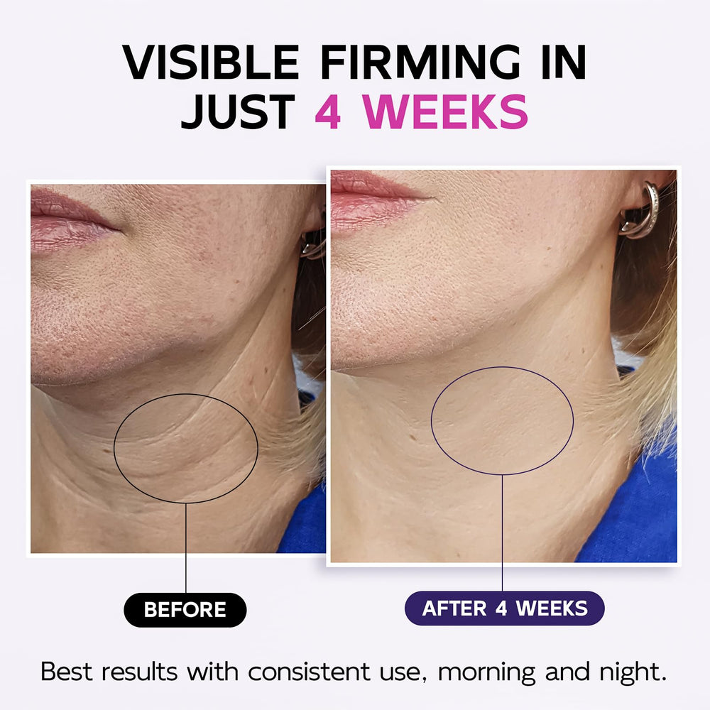GOOSURE retinol-neck-cream close-up highlights potential firming and smoother texture.