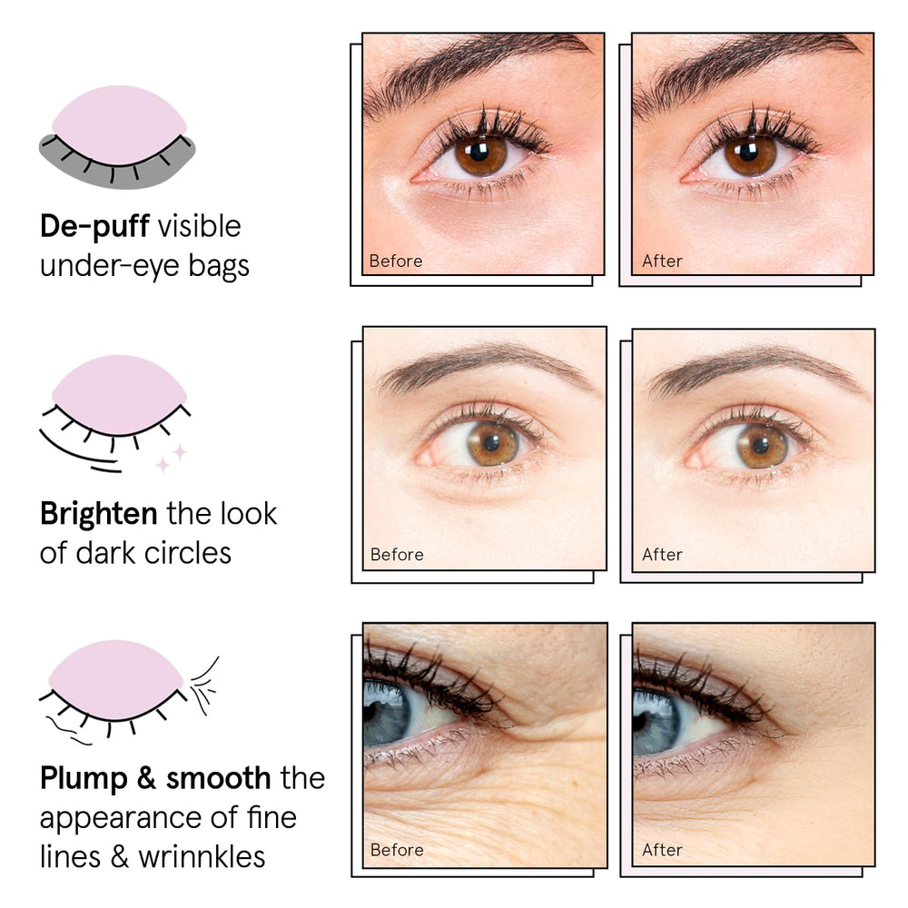 Grace & Stella patches before-after image suggests brightening and reduced puffiness.