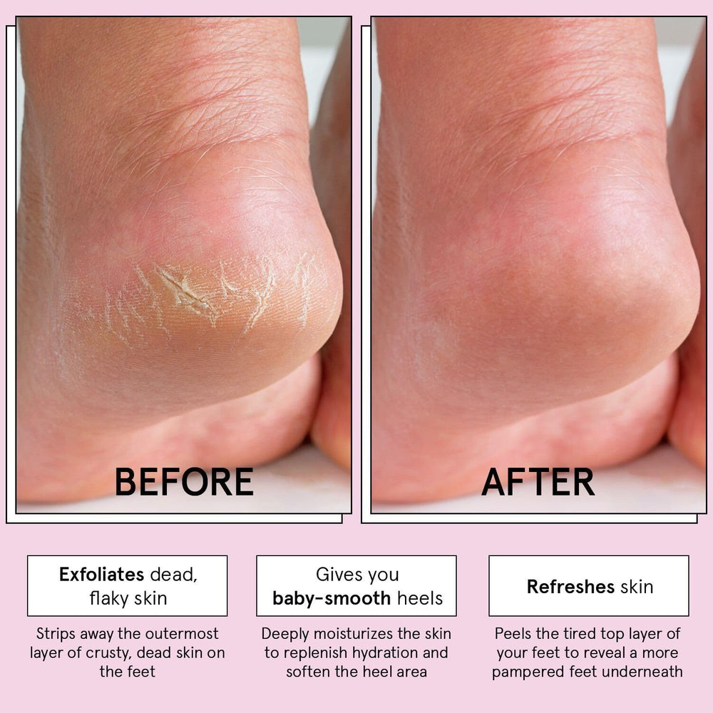 Grace & Stella peeling-action image shows dead-skin removal process