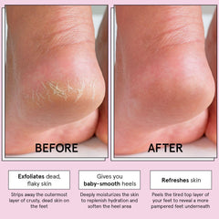 Grace & Stella peeling-action image shows dead-skin removal process