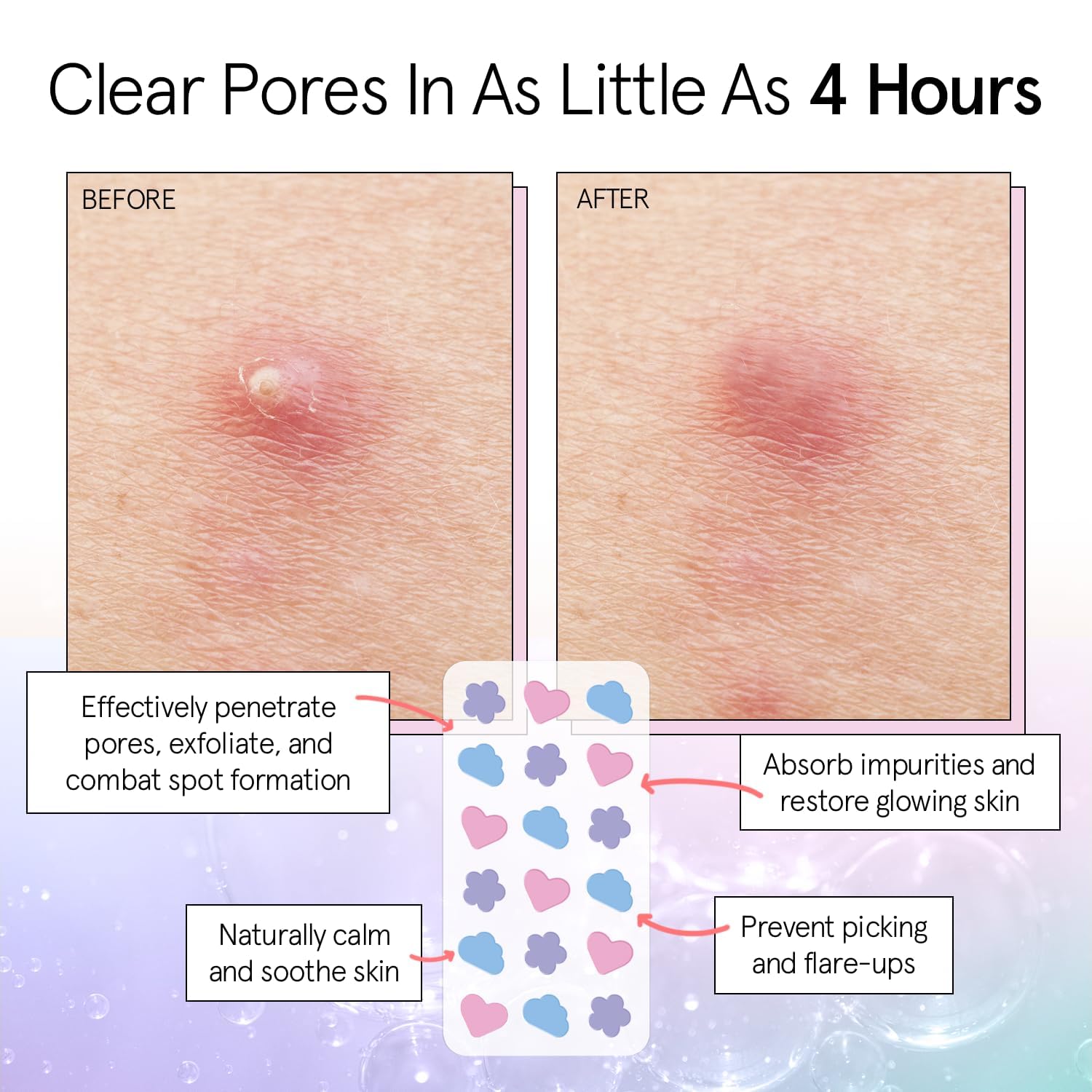Grace & Stella patch infused with tea tree oil for soothing daytime blemishes.
