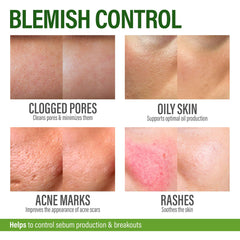 GRAMRIGHT Acne Spot Treatment face dots demonstrates targeted blemish care possibilities.