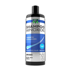 GREEN ROYALTY Minoxidil Shampoo bottle with sulfate-free formula for daily cleansing.
