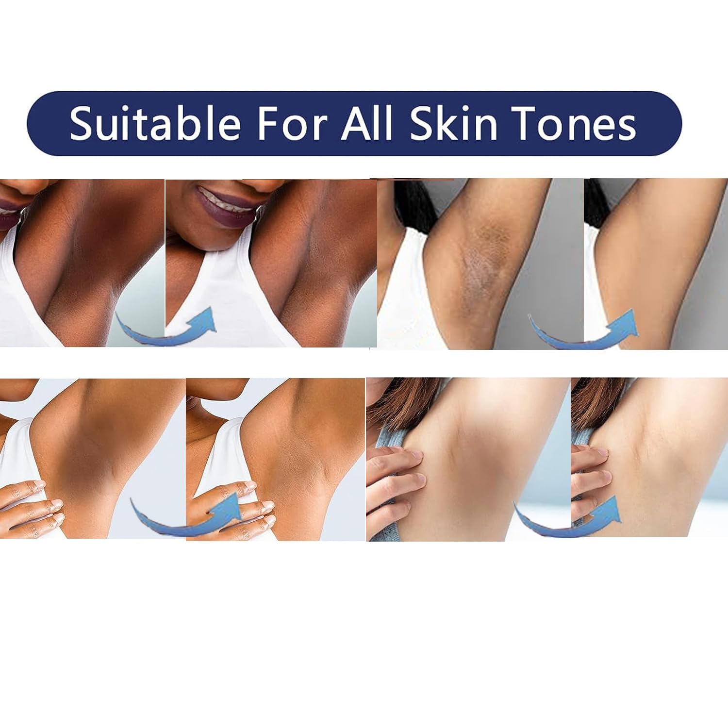 Gukei knees-elbows brightening cream applying for smoother skin tone.