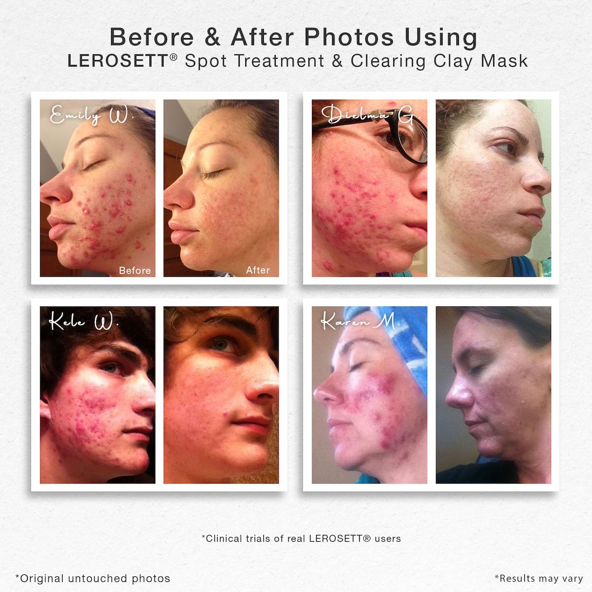 Gunilla Of Sweden LEROSETT applying thin mask demonstrates easy, gentle coverage on skin.