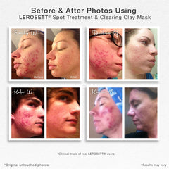 Gunilla Of Sweden LEROSETT applying thin mask demonstrates easy, gentle coverage on skin.