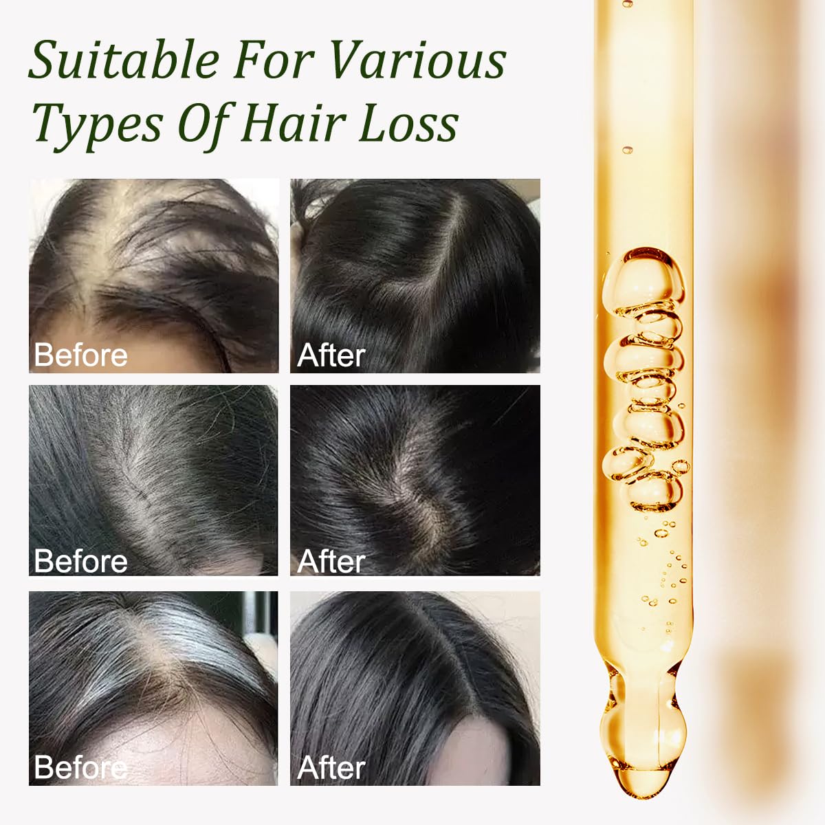 Gypsophila Batana Oil damaged hair repair highlights deep nourishment and smoother strands.