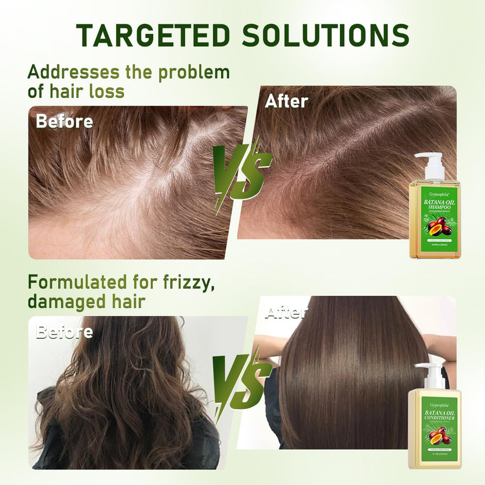 Gypsophila Battana Oil Conditioner bottle — fragrance-free, gentle care for sensitive scalps.
