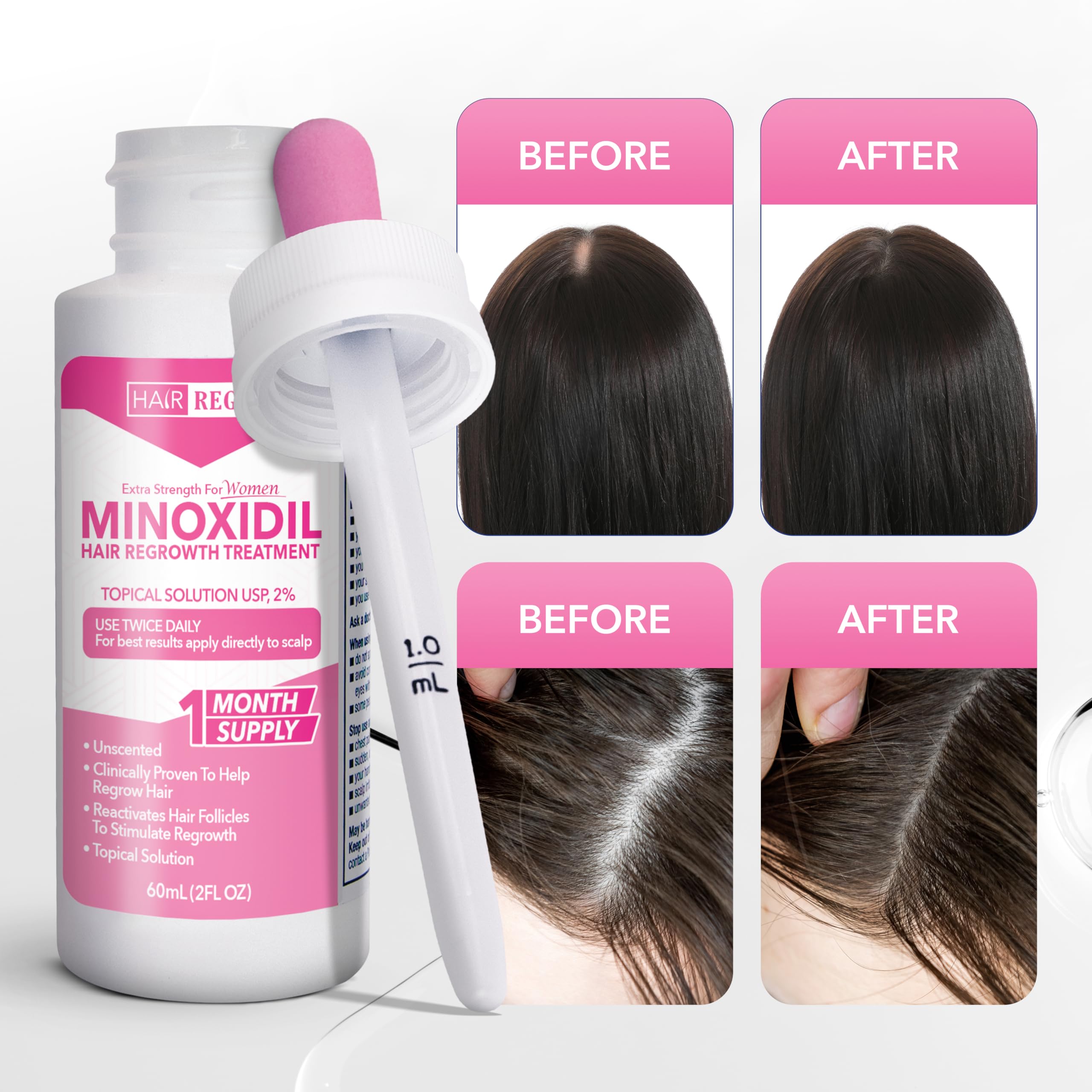 Hair Regen 6-pack kit box for six months of consistent care.