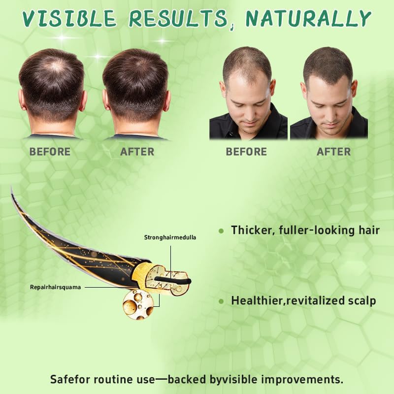 Hair Regrowth System peppermint oil detail suggests refreshing scalp feel