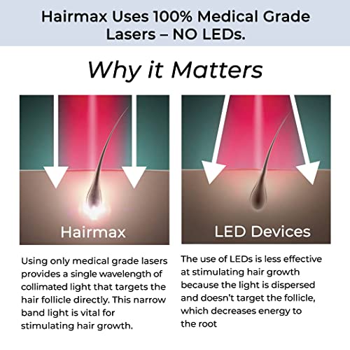 HairMax LaserBand 82 ComfortFlex teeth close-up for gentle fit