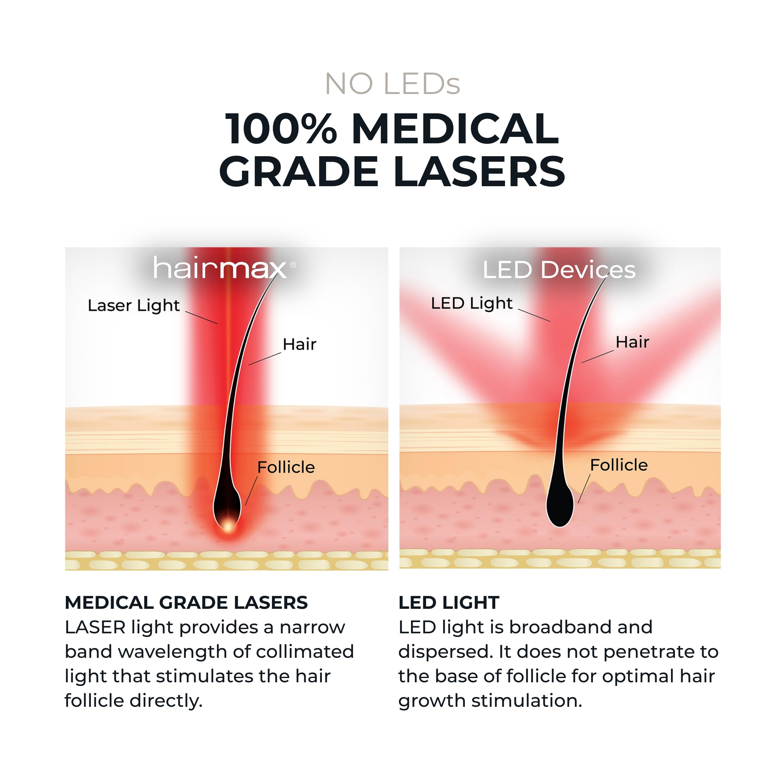 HairMax LaserBand 82 scalp therapy session in progress