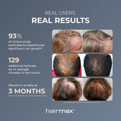 Close-up of Hairmax Ultima 9 Classic medical-grade lasers for follicle stimulation.
