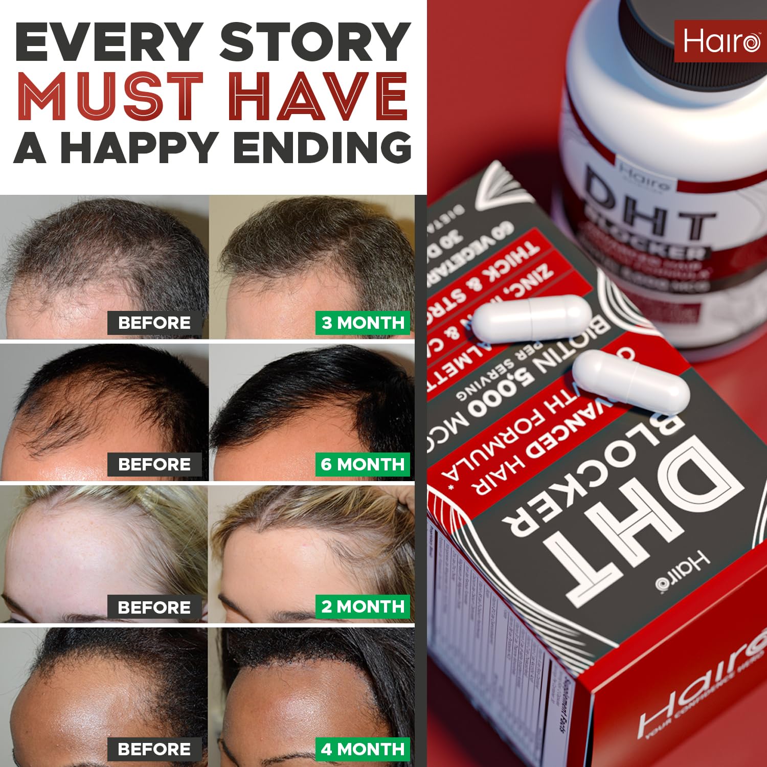 Hairo Nutrition DHT Blocker hair follicle illustration indicating nourishment.