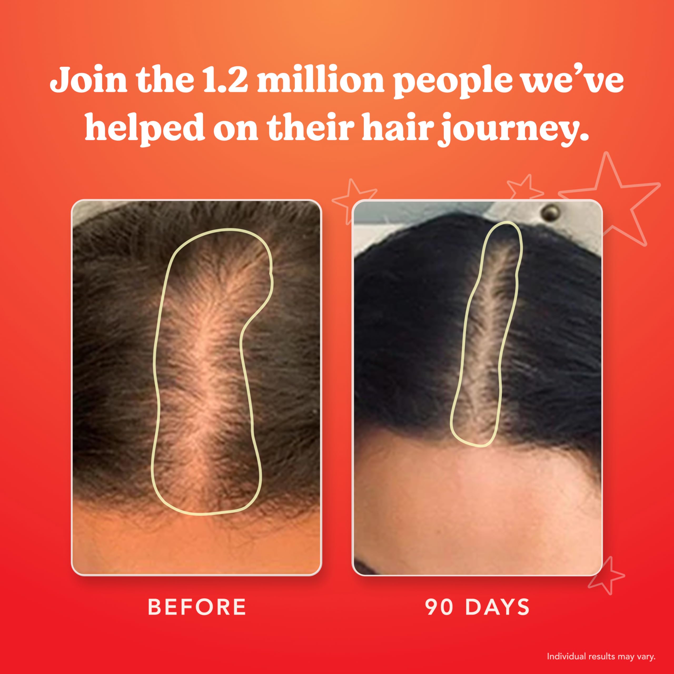 HAIRtamin Gummies for all hair types are suitable for everyone