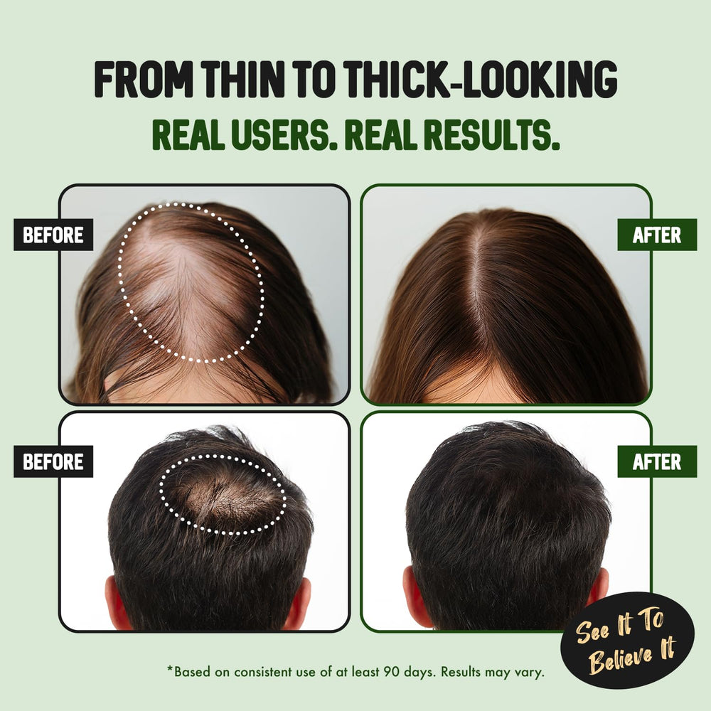 HALOGROW all-hair-types-friendly formula suits diverse textures and lengths.