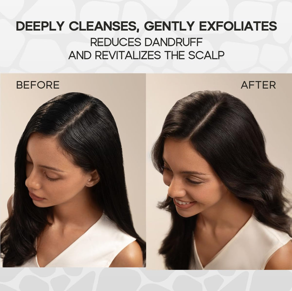 HALOVIDA scalp scrub massage shows cooling relief from mint and rosemary