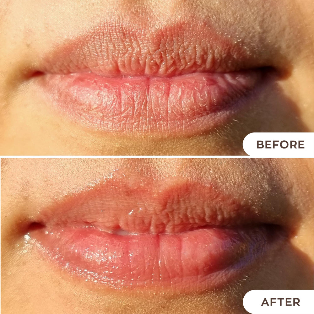 Hanalei Lip Treatment grapeseed-oil soothing shield for lips
