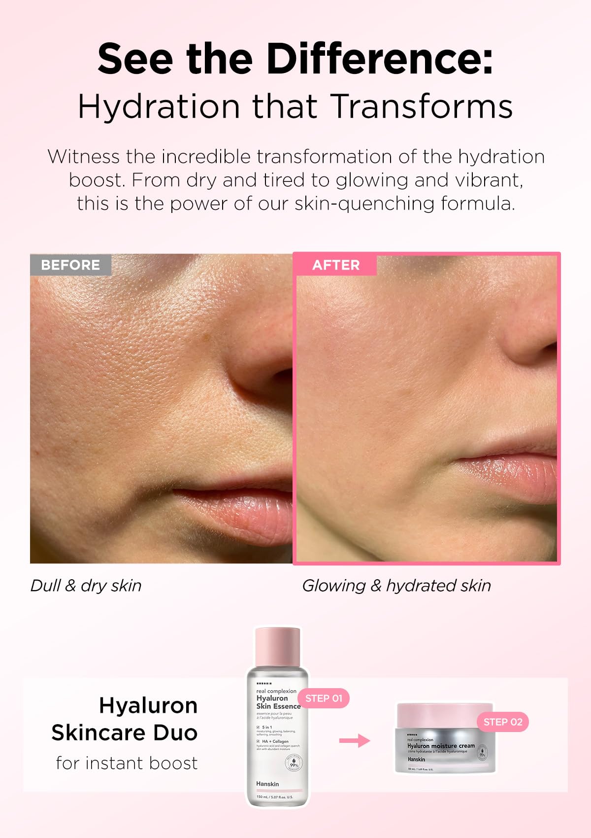 Hanskin Hyaluron Moisture Cream closeup texture emphasizes smooth, barrier-friendly hydration.