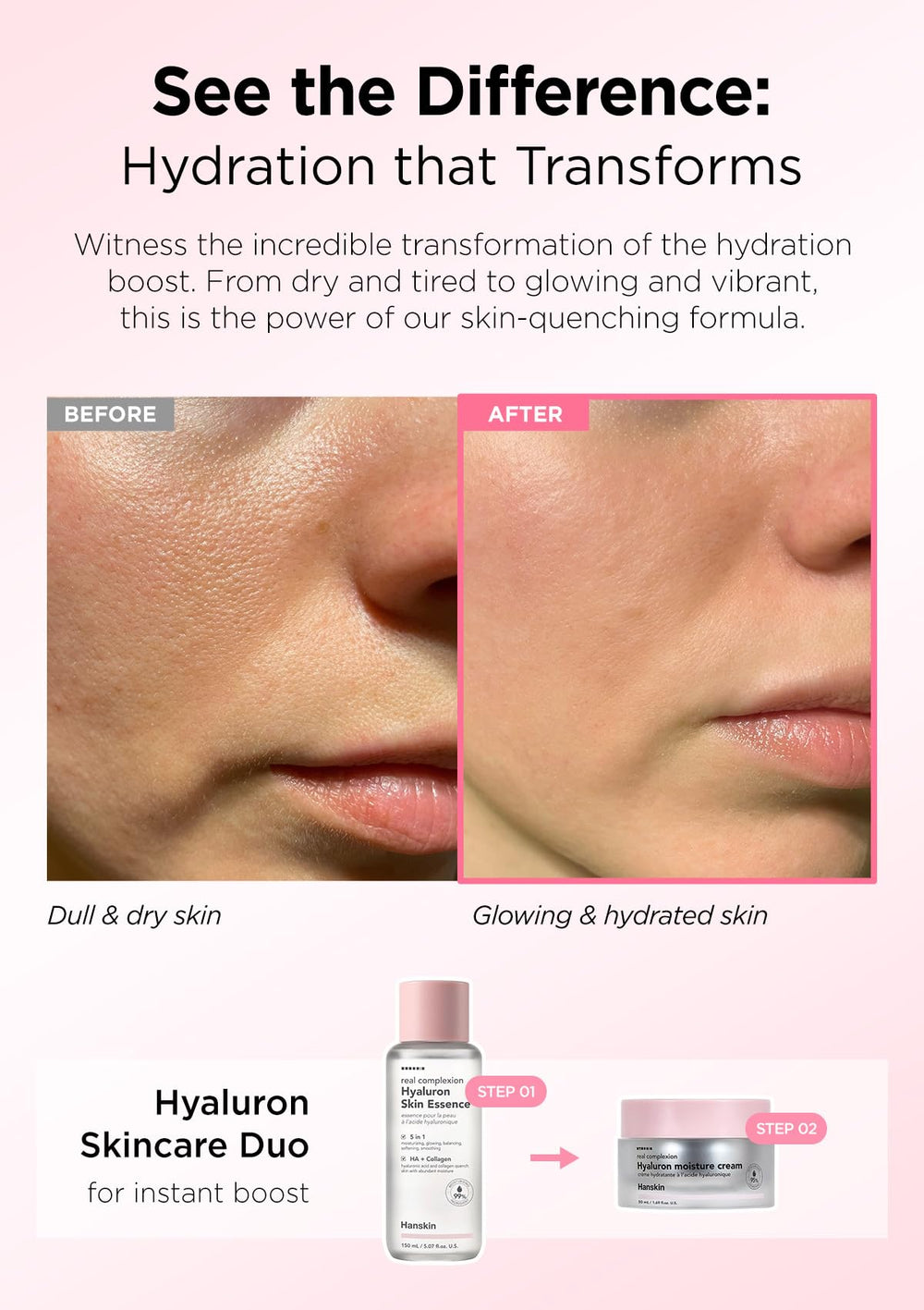 Hanskin Hyaluron Moisture Cream closeup texture emphasizes smooth, barrier-friendly hydration.