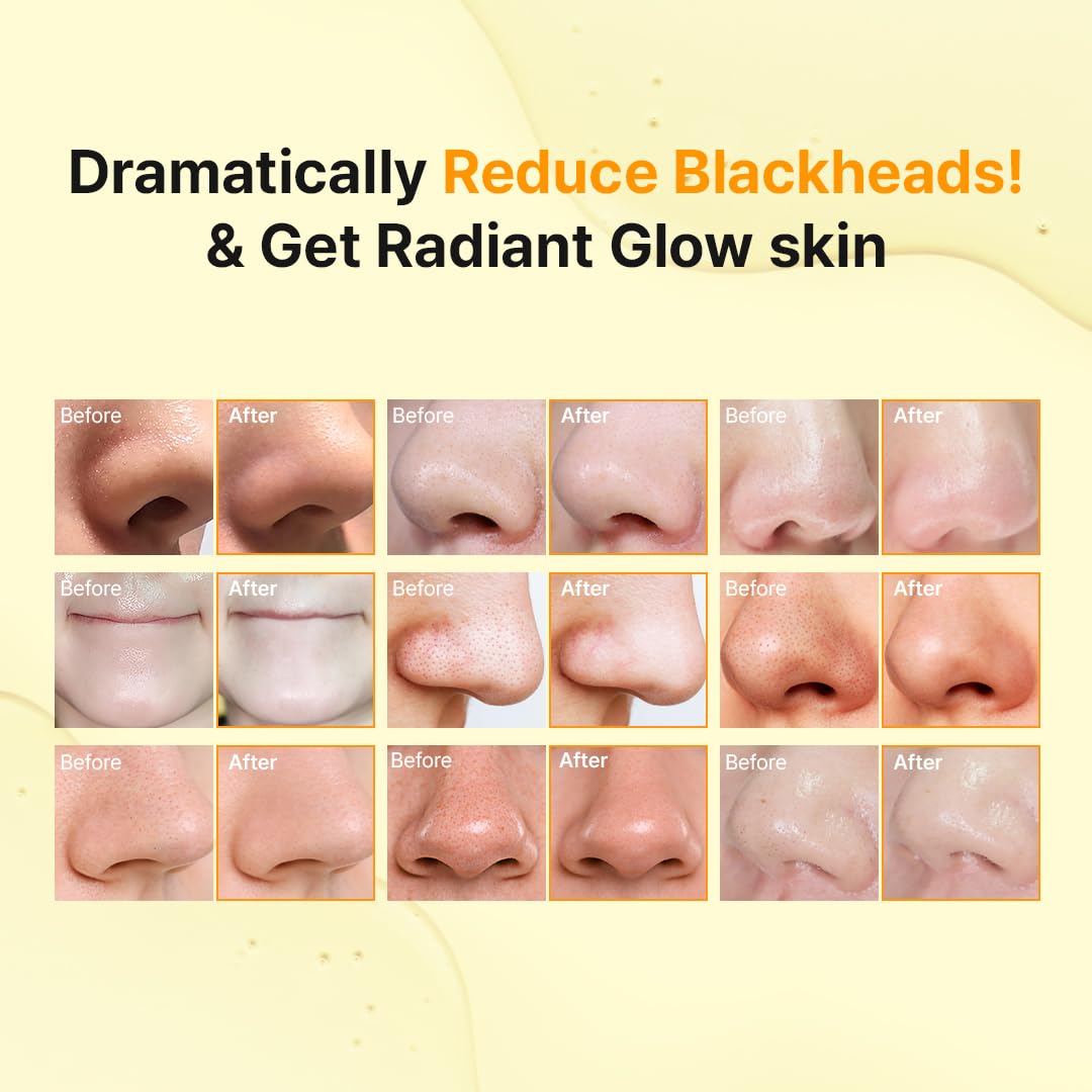 Hanskin Pore Cleansing Oil applied to face for makeup removal and smoother skin.