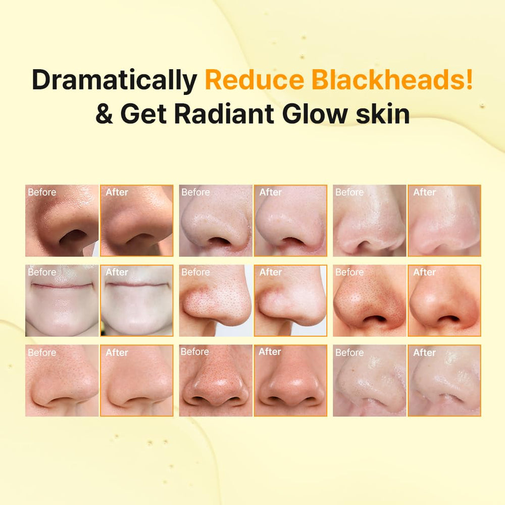 Hanskin Pore Cleansing Oil applied to face for makeup removal and smoother skin.