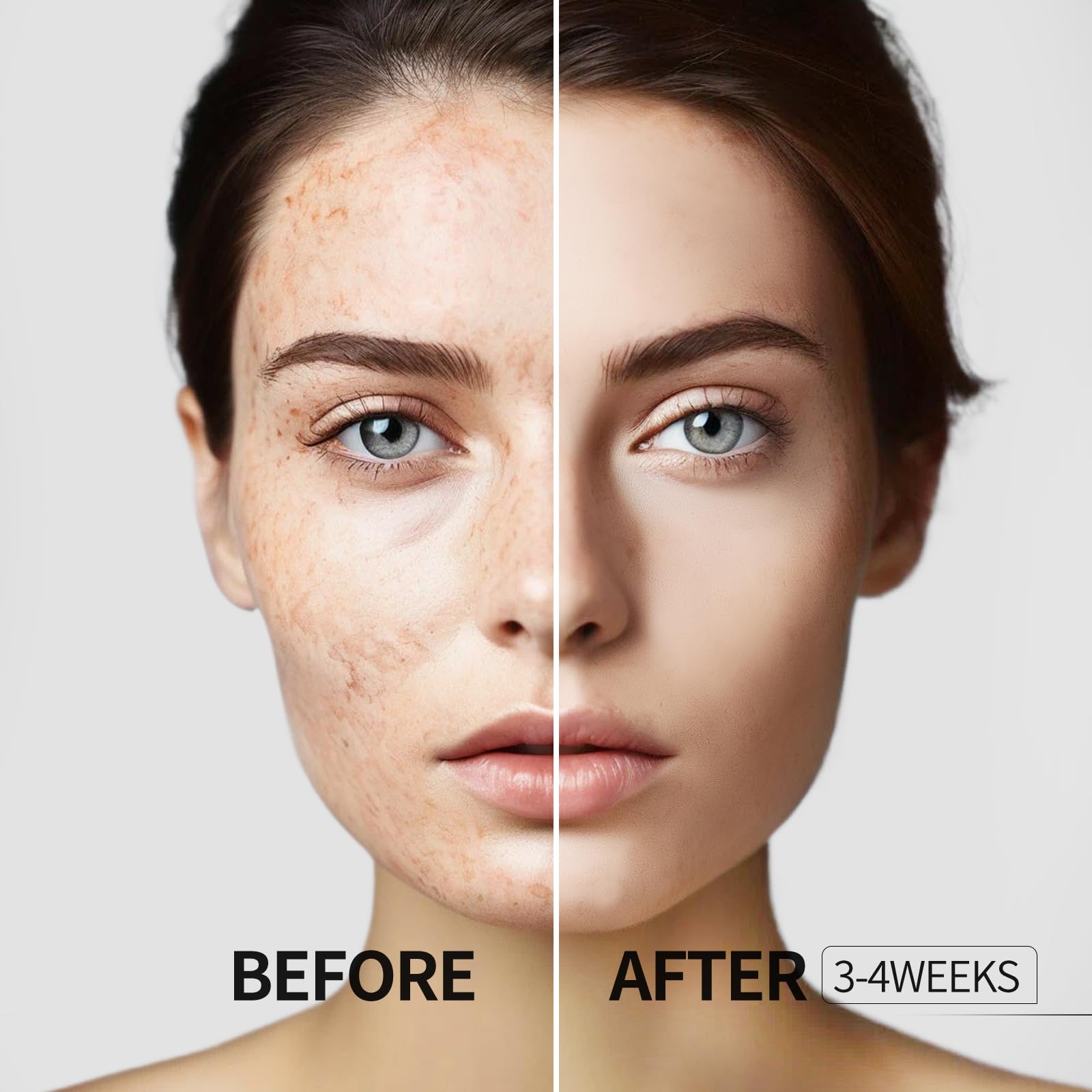 HANYWIL fast-absorbing formula shown on skin for quick fade of spots.