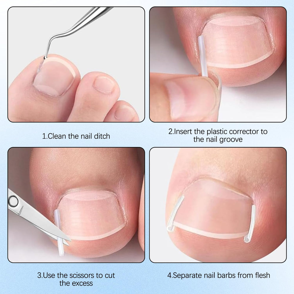 HDFDREO home-use ingrown-nail tools support self-care routines anywhere, anytime