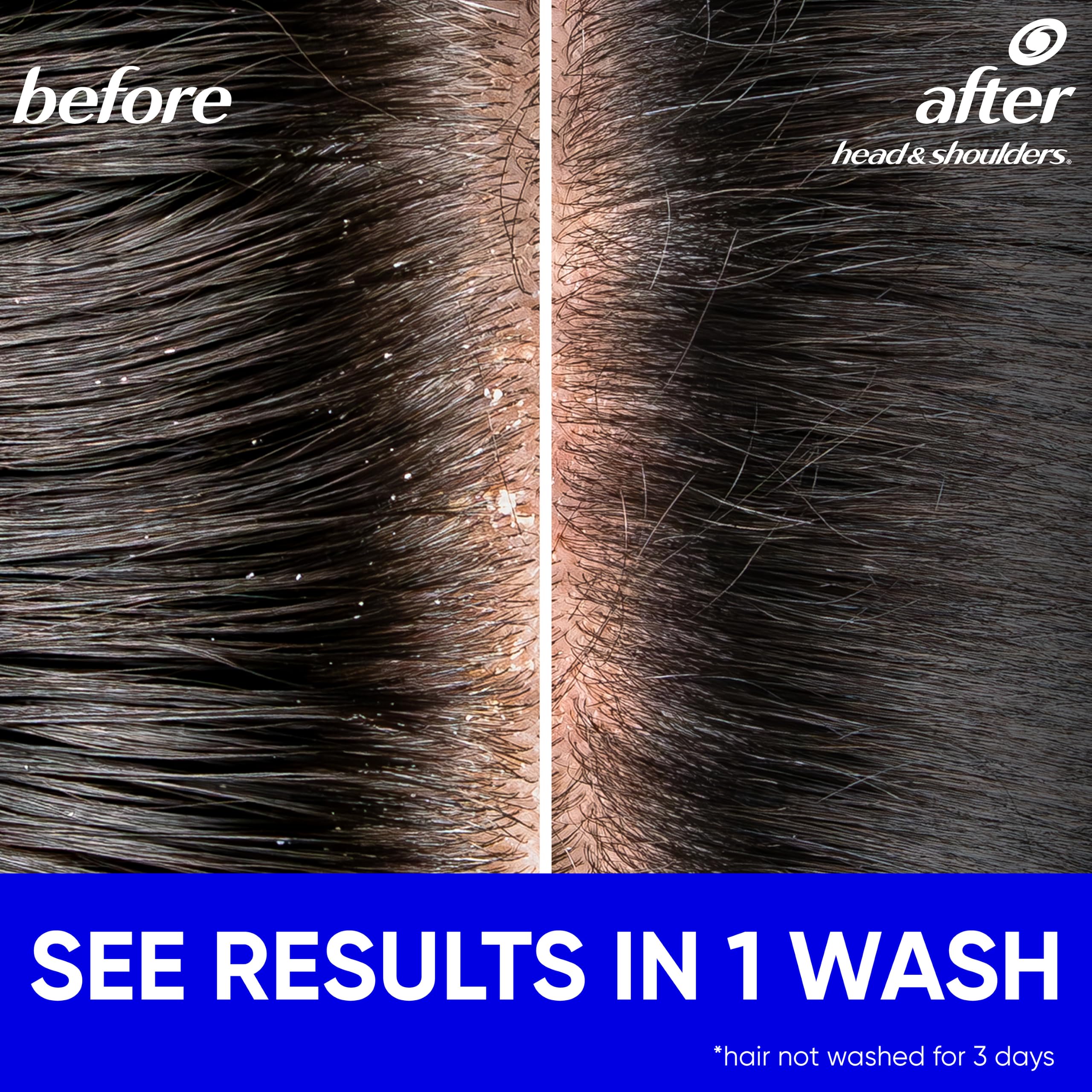 Head & Shoulders rich lather close-up showing effective cleansing foam