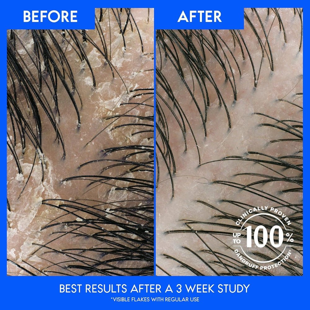 Pouring the Head & Shoulders shampoo to show creamy texture and easy scalp application