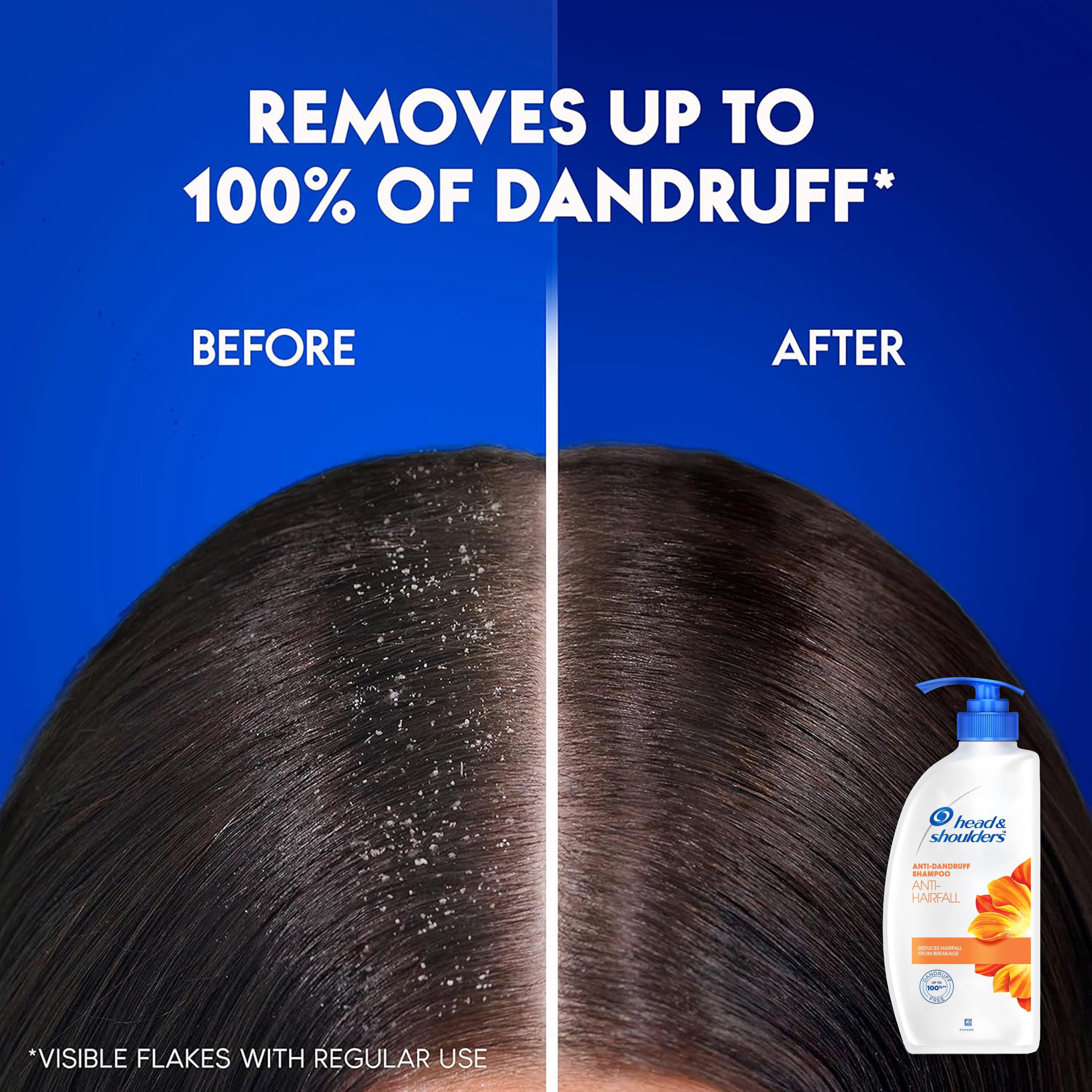 Head & Shoulders bathroom setup scene highlights easy-access storage for scalp care.